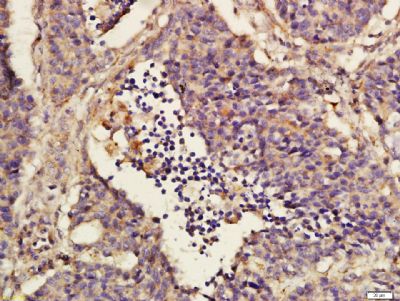 G蛋白偶联受体40抗体