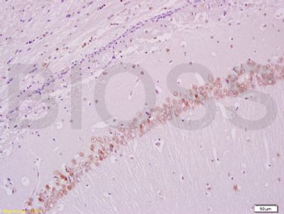 5-溴脱氧尿嘧啶核苷（增殖标志物）单克隆抗体