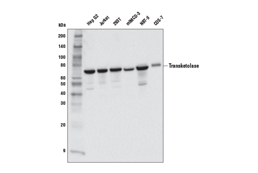 Transketolase (E7O4M) Rabbit mAb