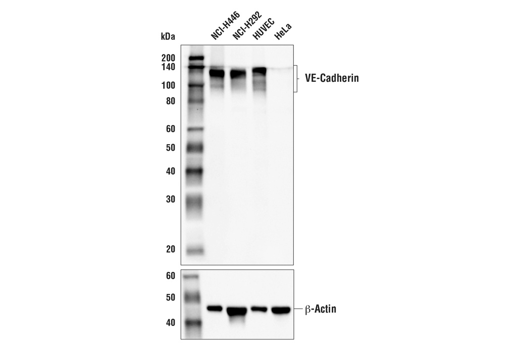 VE-Cadherin (E6N7A) Rabbit mAb