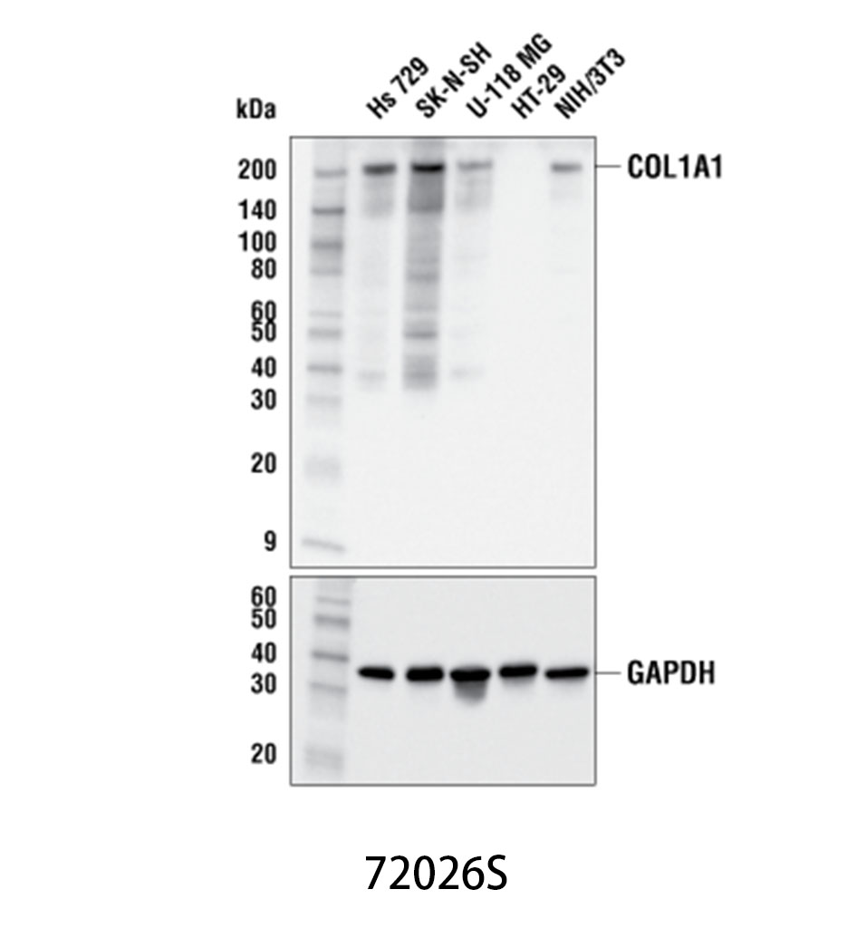 COL1A1 (E8F4L) XP Rabbit mAb