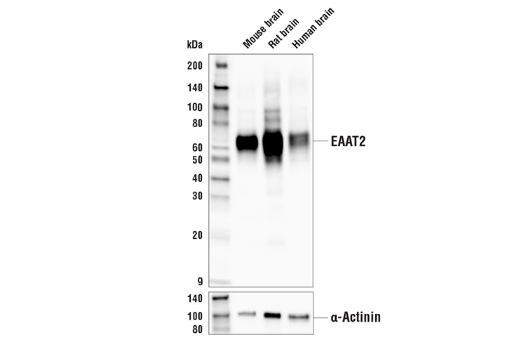 EAAT2 (E3P5K) Rabbit mAb