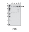 PERK (C33E10) Rabbit mAb