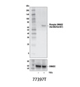 TGF-β Fibrosis Pathway Antibody Sampler Kit
