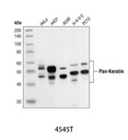 Pan-Keratin (C11) Mouse mAb