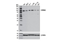 Autophagy Vesicle Nucleation Antibody Sampler Kit