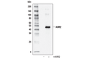 AIM2 Antibody (Mouse Specific)