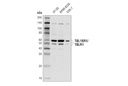 TBL1XR1/TBLR1 (D4J9C) Rabbit mAb