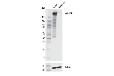 COL11A1 Antibody