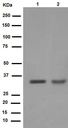 Anti-Cyclin D1 antibody [EPR2241]